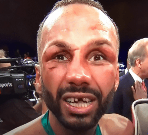 degale_teeth